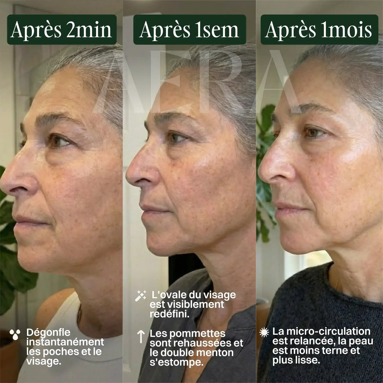 Brosse lymphatique visage NEXORA™